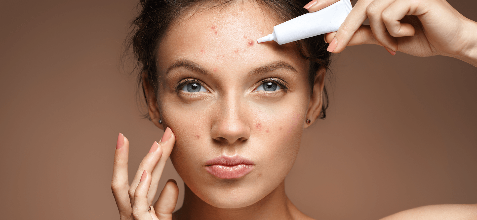 3 Manfaat Salicylic Acid yang Belum Banyak Diketahui Orang